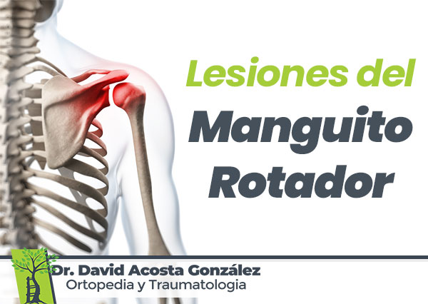 Lesiones-del-Manguito-Rotador-Dr.-David-Acosta-Gonzalez-Ortopedia-y-Traumatologia