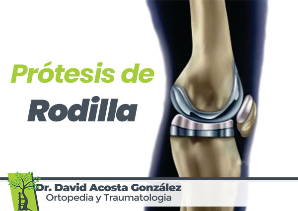Protesis-de-Rodilla-Dr-David-Acosta-Gonzalez-Ortopedia-y-Traumatologia-en-Chihuahua